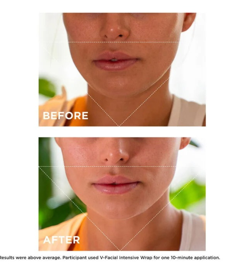 V-FACIAL INTENSIVE WRAP DEPUFFING FACE MASK