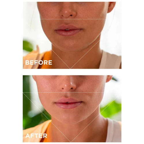 V-FACIAL INTENSIVE WRAP DEPUFFING FACE MASK