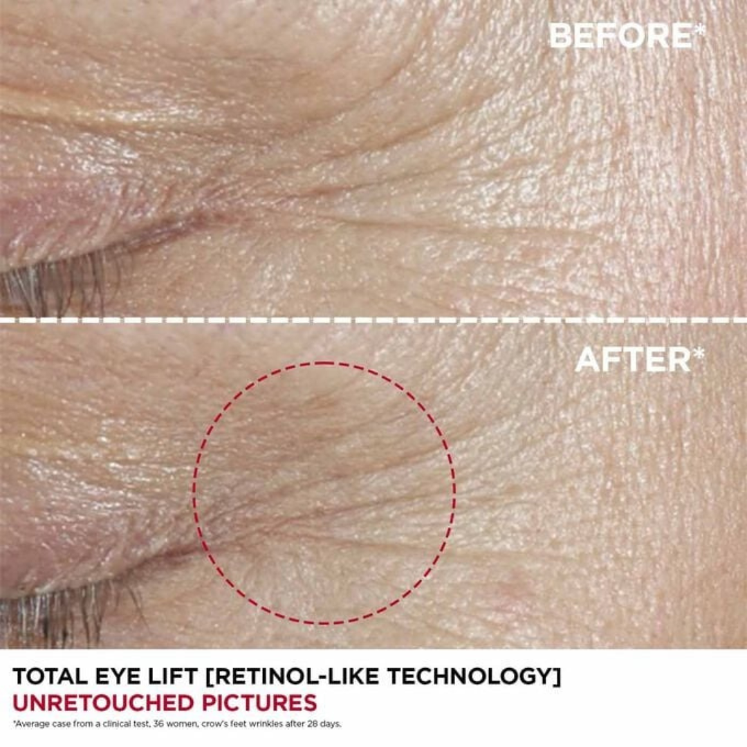 TOTAL EYE LIFT