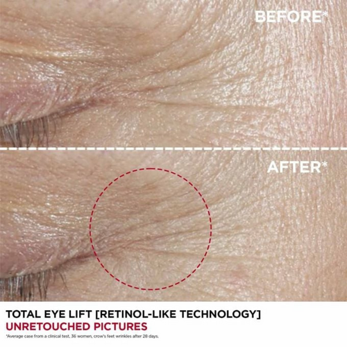 TOTAL EYE LIFT