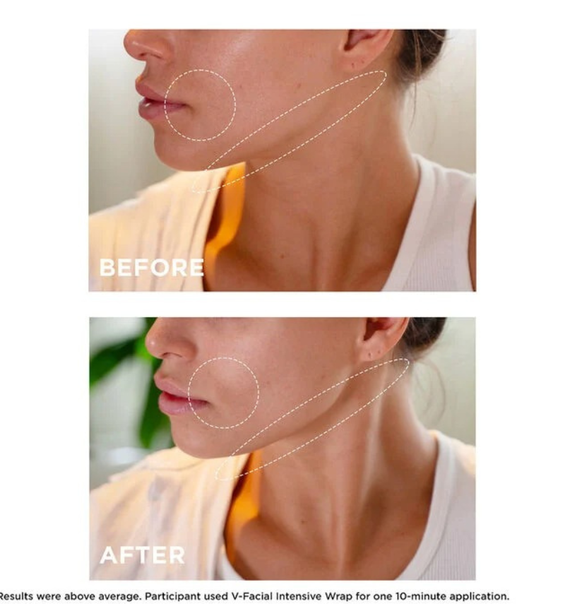 V-FACIAL INTENSIVE WRAP DEPUFFING FACE MASK