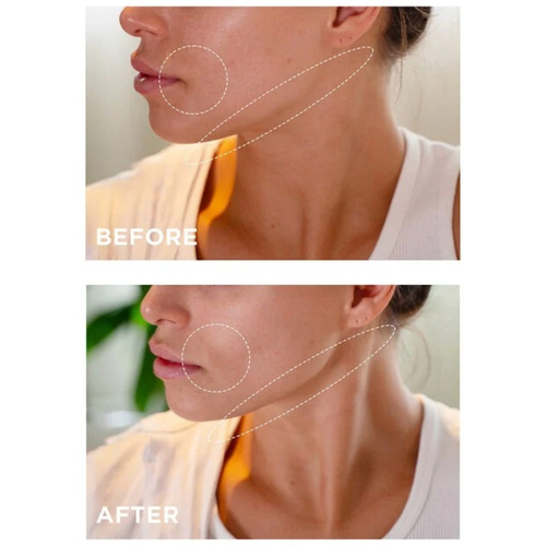 V-FACIAL INTENSIVE WRAP DEPUFFING FACE MASK