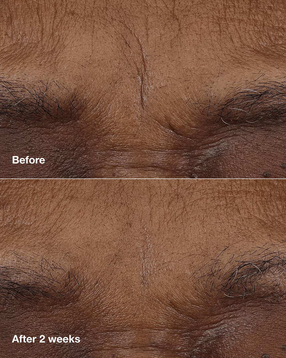 CLINIQUE SMART CLINICAL REPAIR™ AM/PM RETINOID BALM