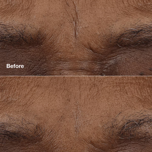 CLINIQUE SMART CLINICAL REPAIR™ AM/PM RETINOID BALM