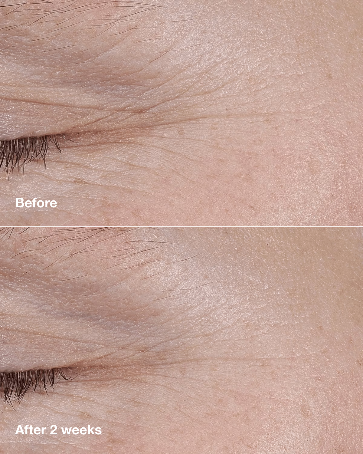 CLINIQUE SMART CLINICAL REPAIR™ AM/PM RETINOID BALM