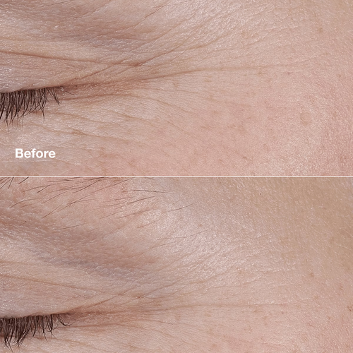 CLINIQUE SMART CLINICAL REPAIR™ AM/PM RETINOID BALM