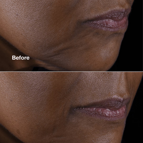 CLINIQUE SMART CLINICAL REPAIR™ LIFTING FACE + NECK CREAM