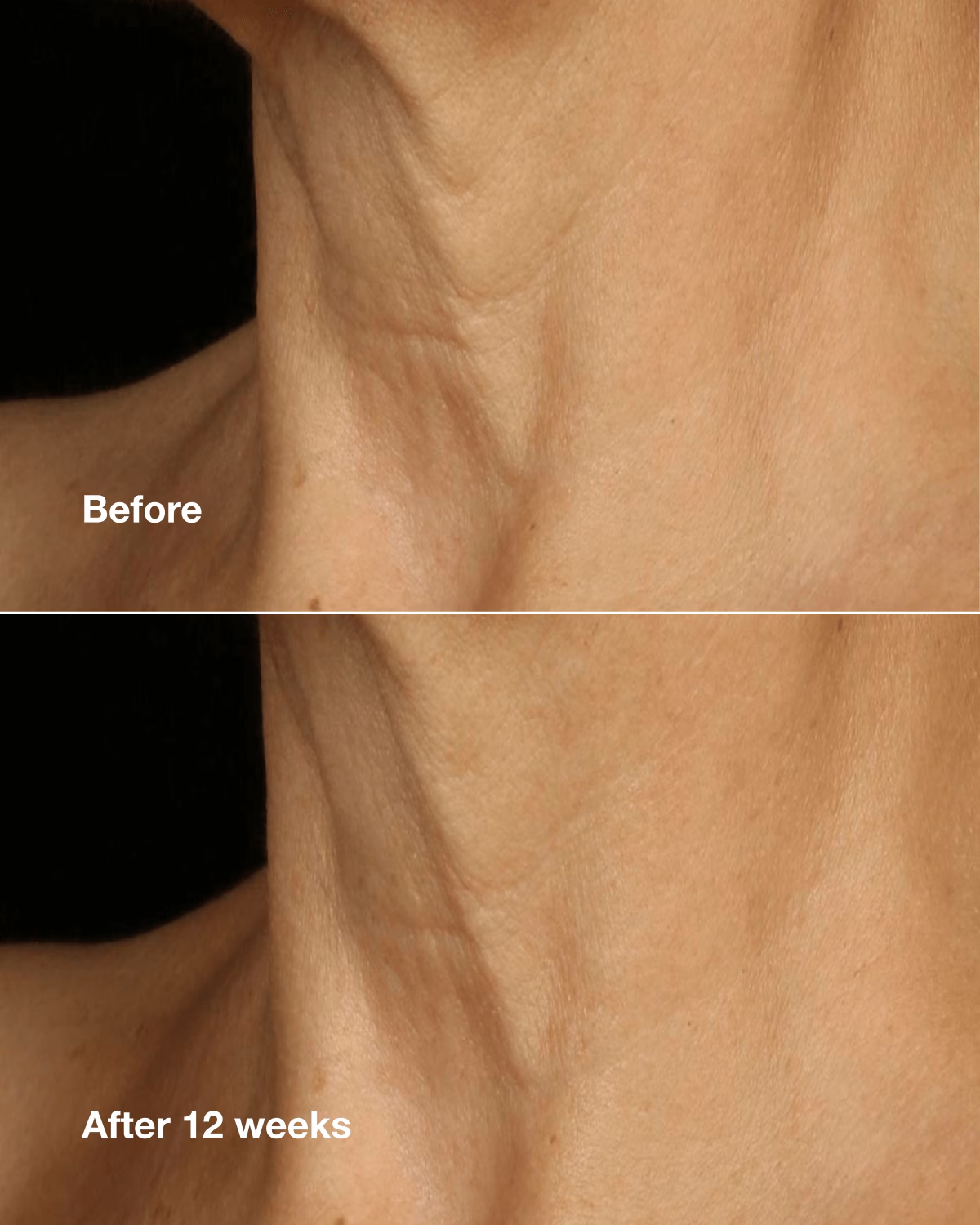 CLINIQUE SMART CLINICAL REPAIR™ LIFTING FACE + NECK CREAM
