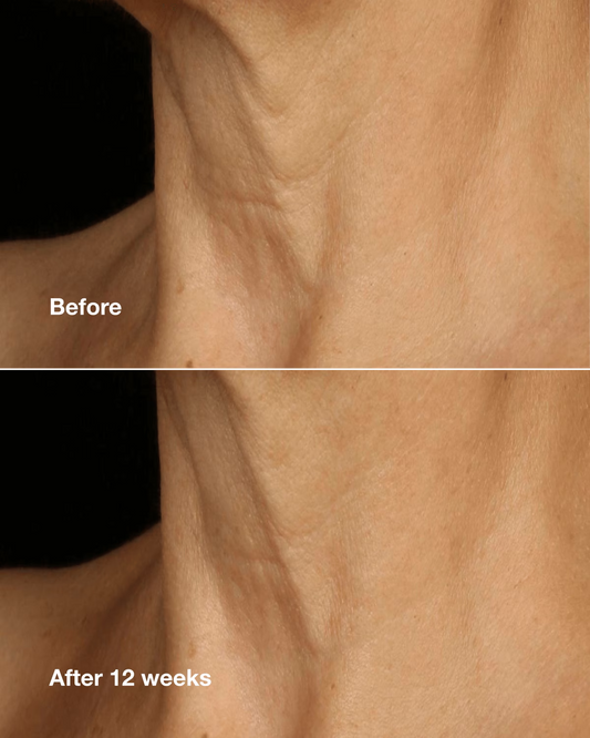 CLINIQUE SMART CLINICAL REPAIR™ LIFTING FACE + NECK CREAM