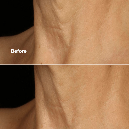 CLINIQUE SMART CLINICAL REPAIR™ LIFTING FACE + NECK CREAM