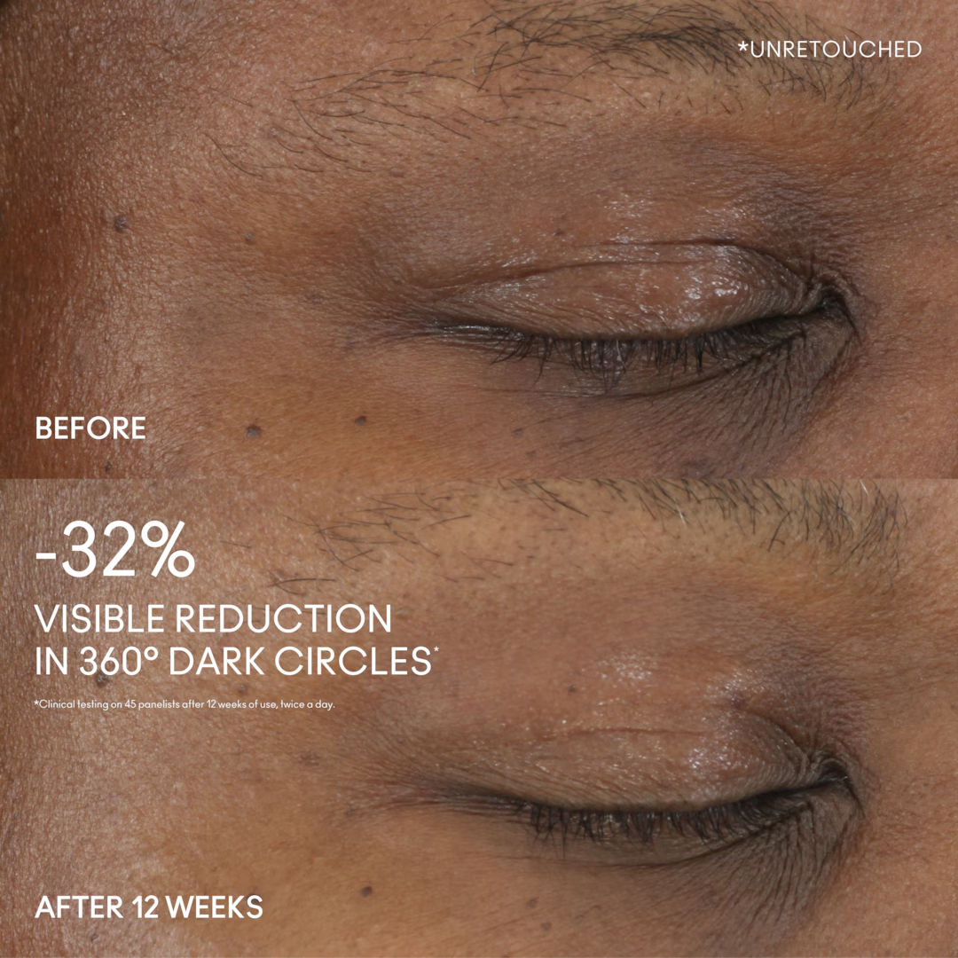HYPER REAL SERUMIZER™ EYE 360° BRIGHT EYE TREATMENT