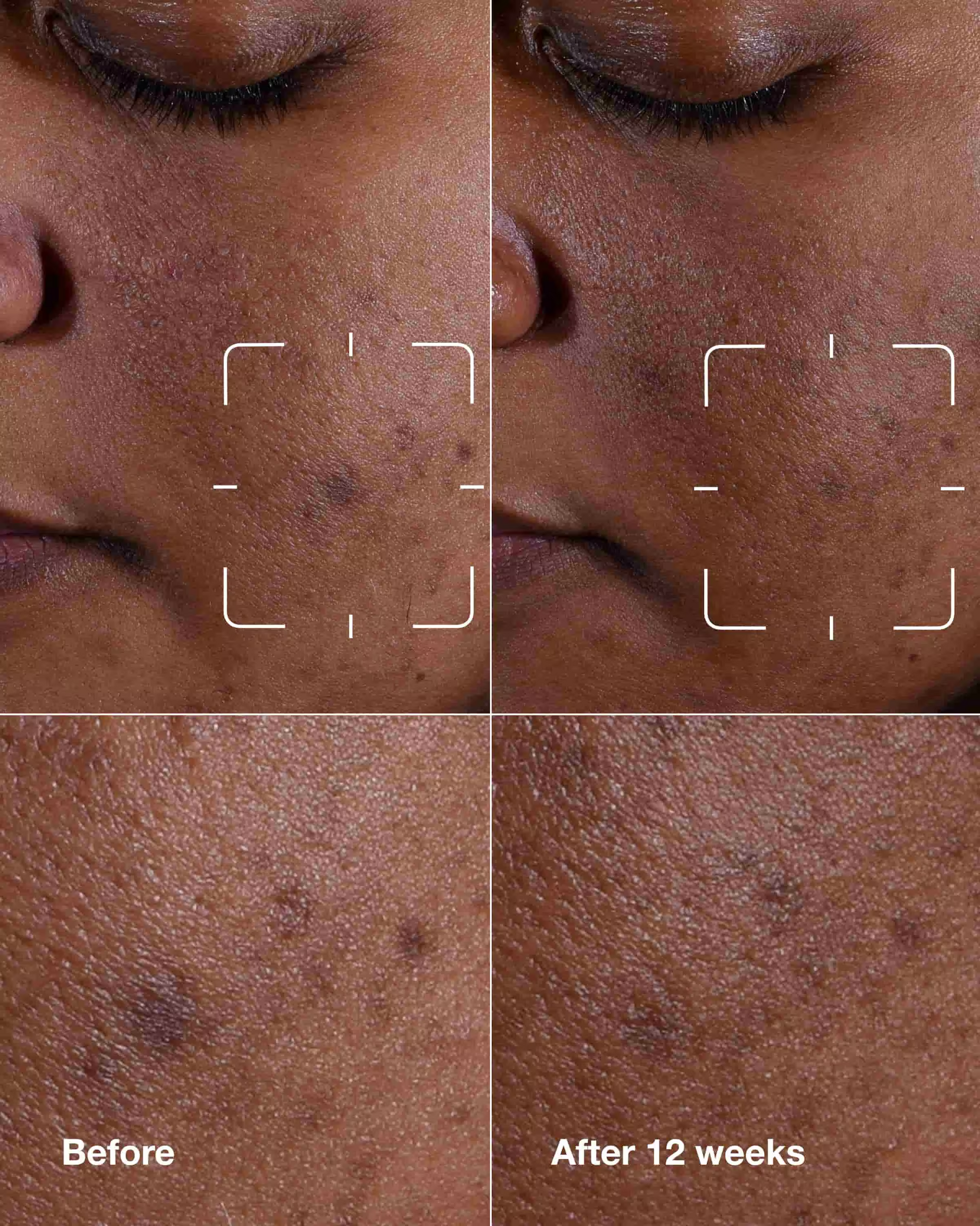 EVEN BETTER CLINICAL™ DARK SPOT CLEARING SERUM