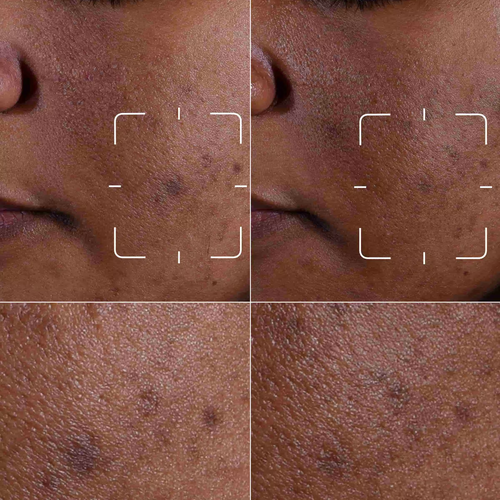 EVEN BETTER CLINICAL™ DARK SPOT CLEARING SERUM